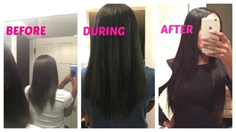 biotin 10000 mcg hair growth before and after|Benefits and Side Effects of Biotin Supplements.